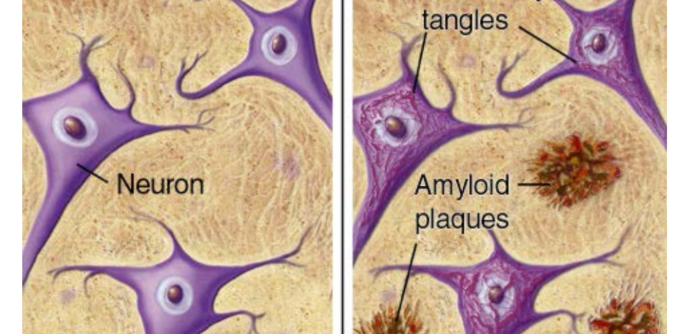 Combinatorial Tau Protein